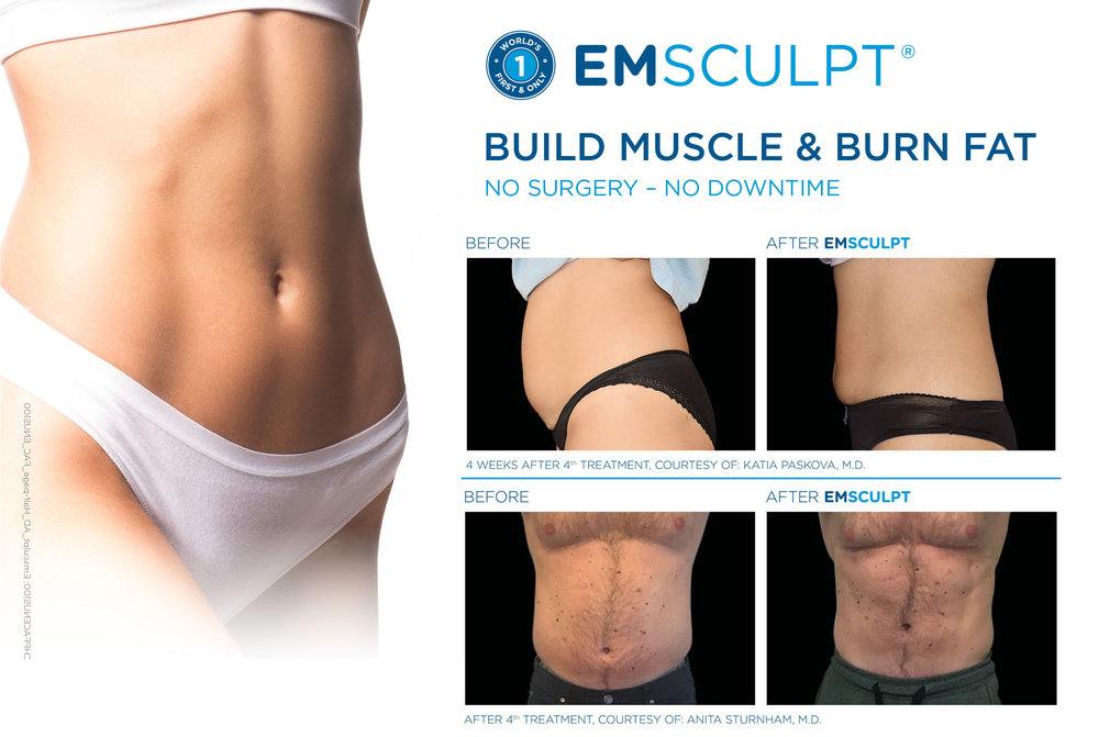 Benefits of EMS Sculpting for Muscle Toning and Fat Reduction, by myChway  UK